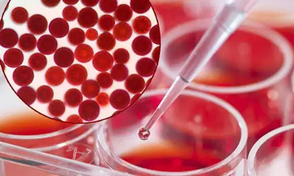 Can Astaxanthin Powder And Oil Improve Eye and Vision Health?
